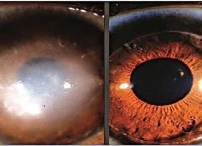 عینکی ها این خوراکی را حتما بخورند عینکی ها این خوراکی را حتما بخورند